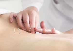 Accupuncture Treatment Benefits